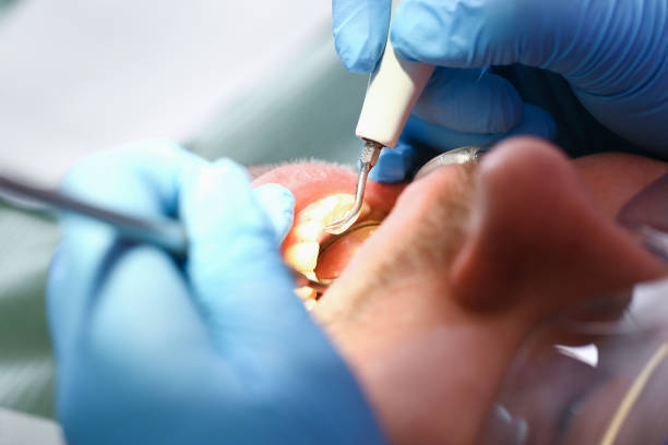 Best Emergency Care for Gum Disease in Forestbrook, SC