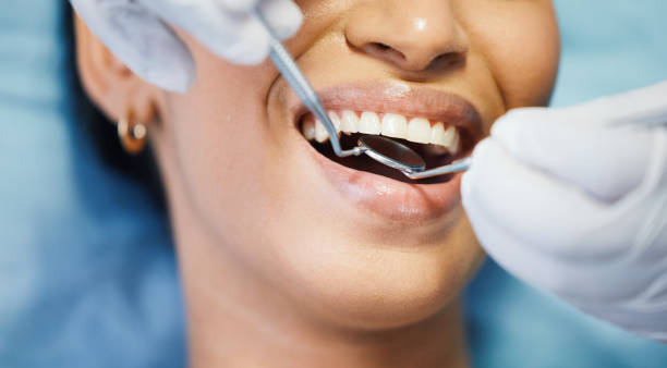 Best Emergency Dental Care for Sports Injuries in Forestbrook, SC