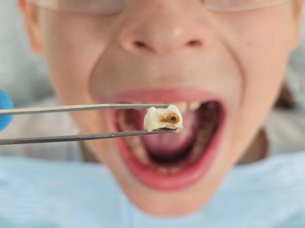 Best Emergency Orthodontic Repairs in Forestbrook, SC